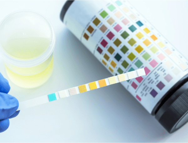 Why Urinalysis is Critical to Your Success